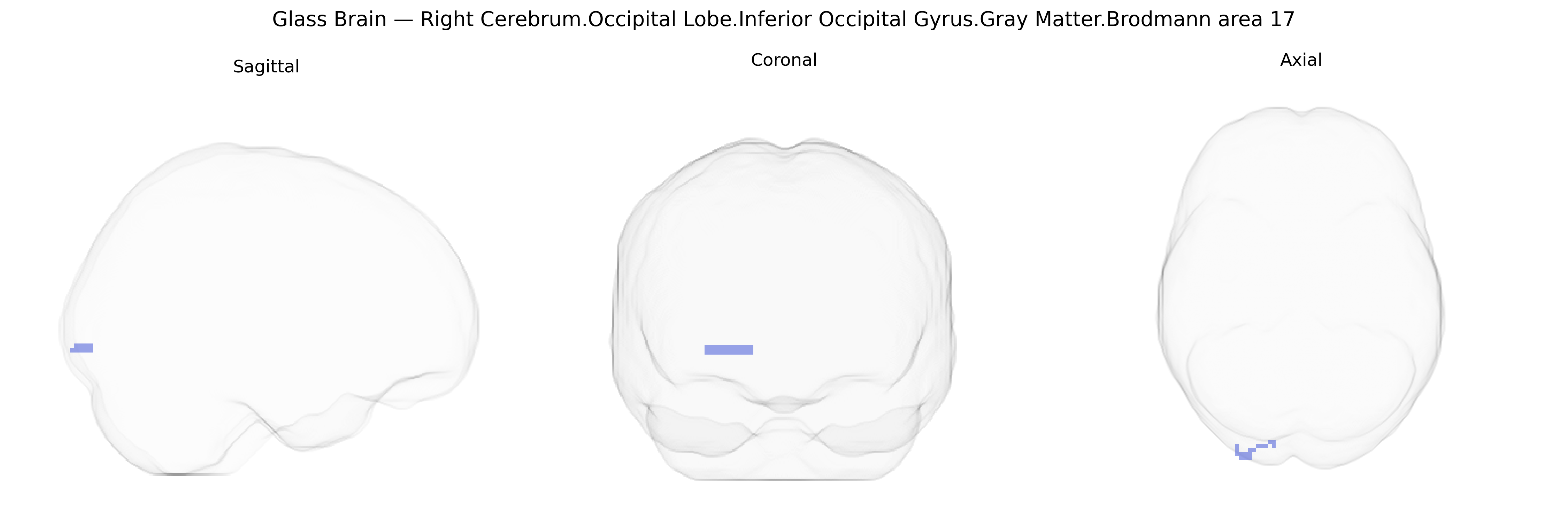 Triplanar Ghost Brain