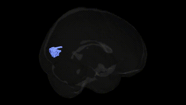 Full Brain Black