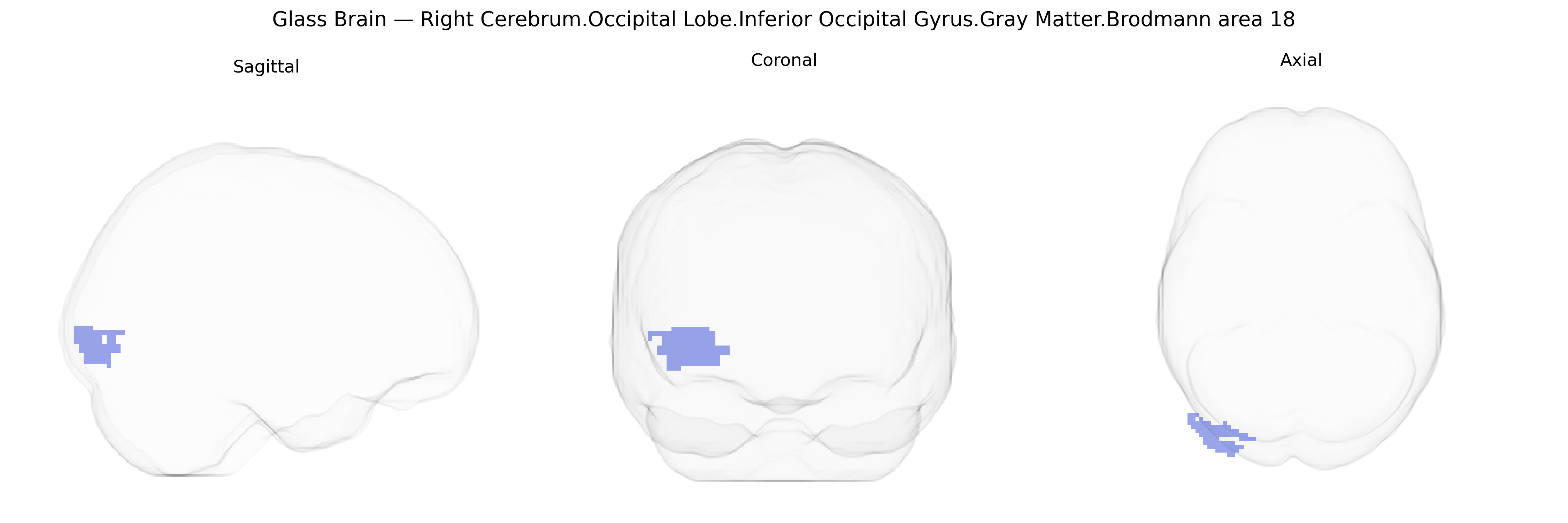 Triplanar Ghost Brain