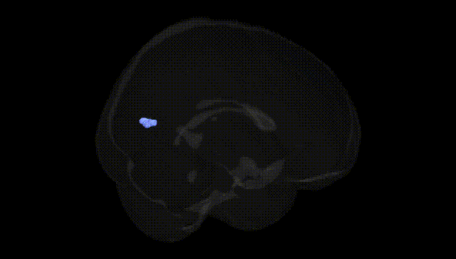 Full Brain Black