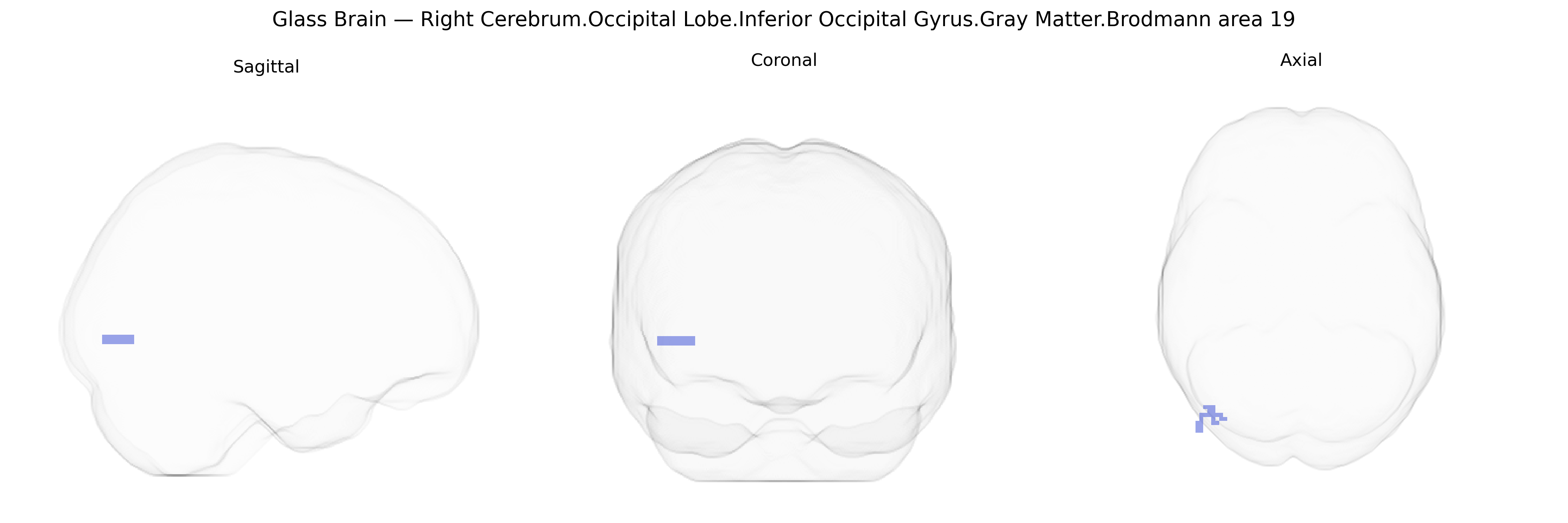 Triplanar Ghost Brain