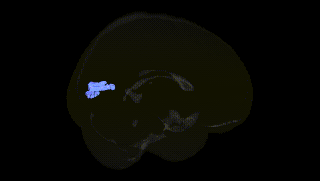Full Brain Black