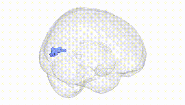 Full Brain White