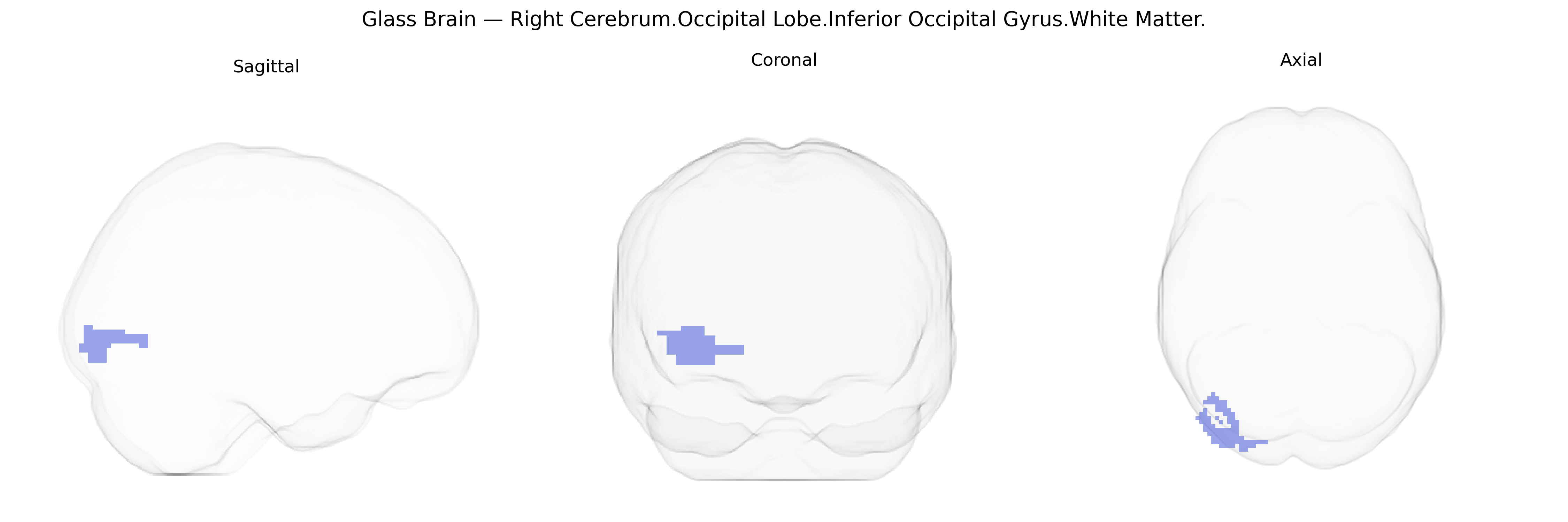 Triplanar Ghost Brain
