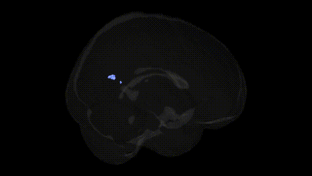 Full Brain Black
