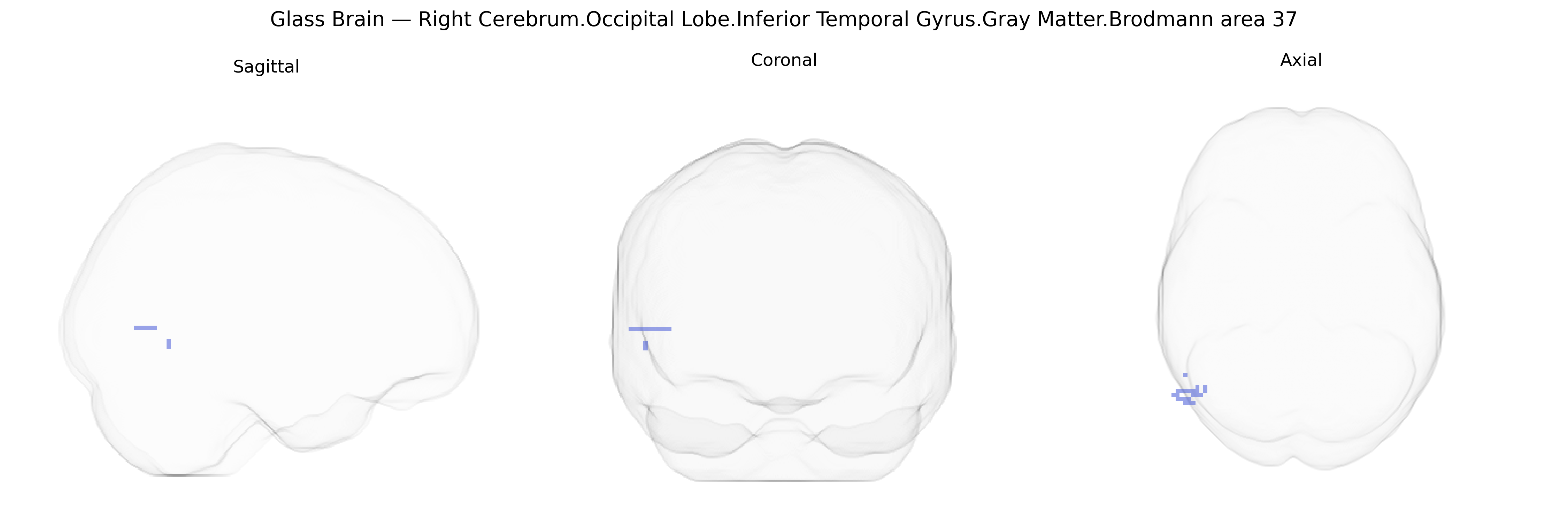 Triplanar Ghost Brain
