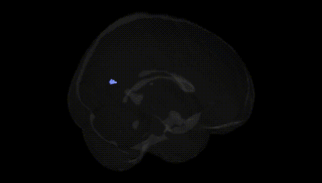 Full Brain Black