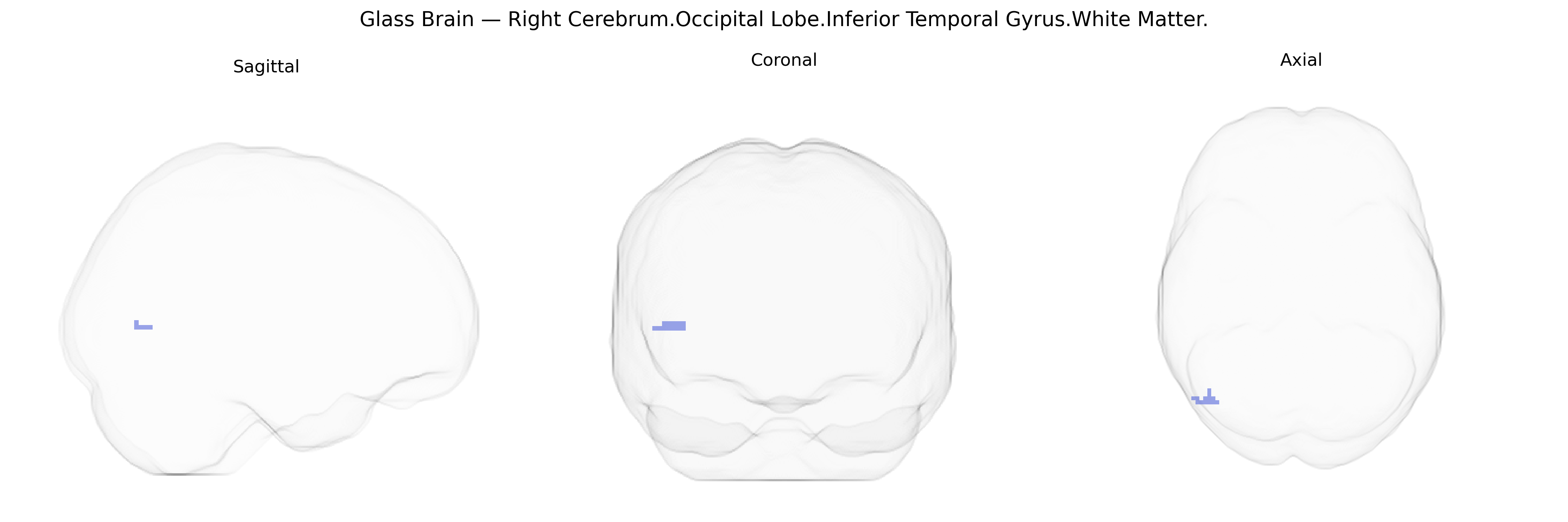 Triplanar Ghost Brain
