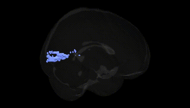 Full Brain Black