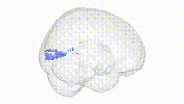 Full Brain White