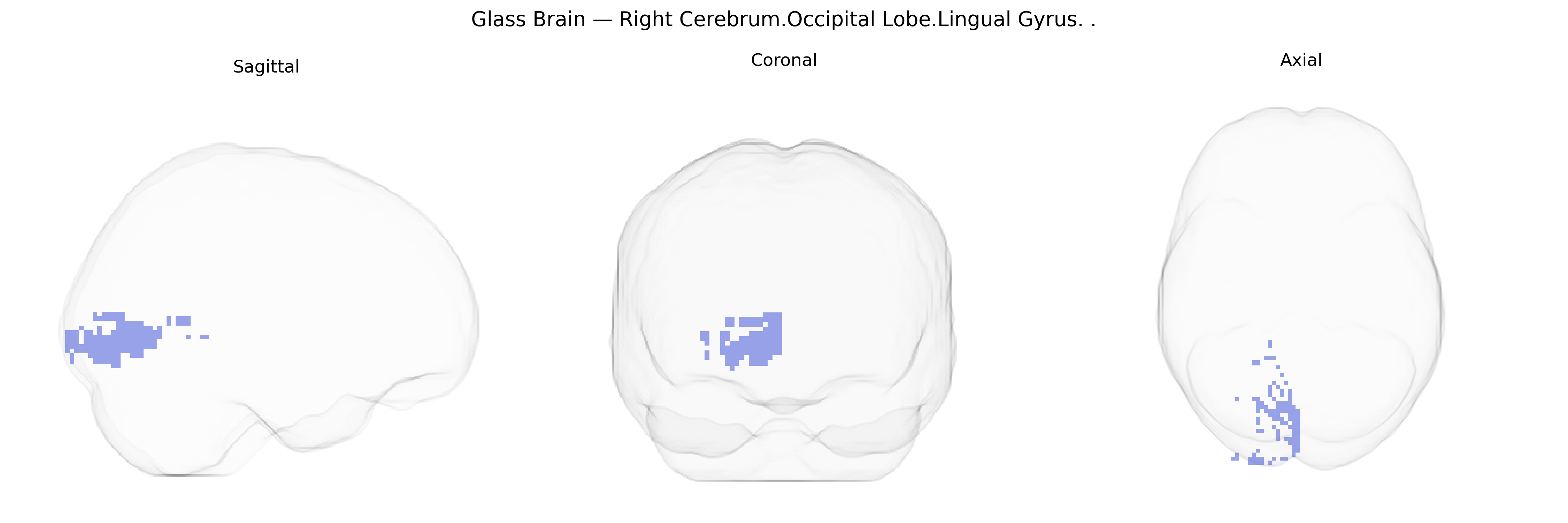 Triplanar Ghost Brain