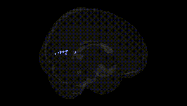 Full Brain Black
