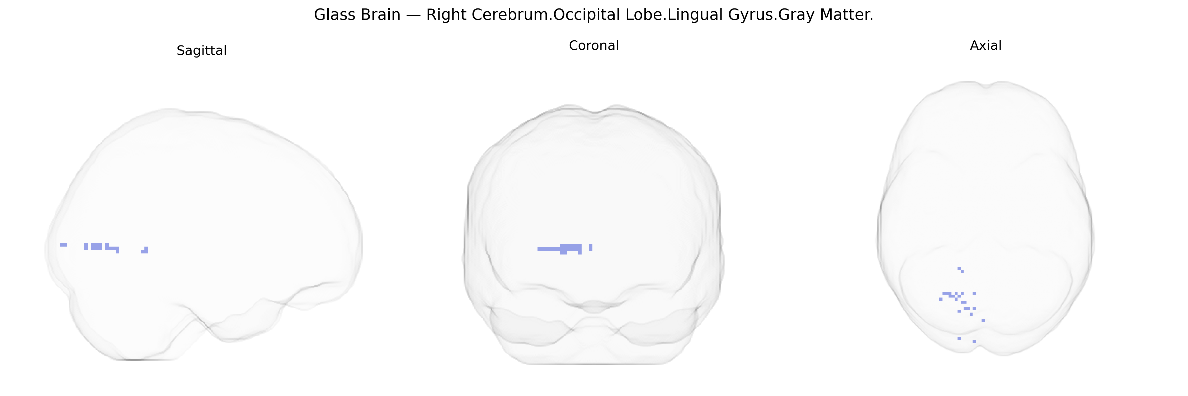 Triplanar Ghost Brain