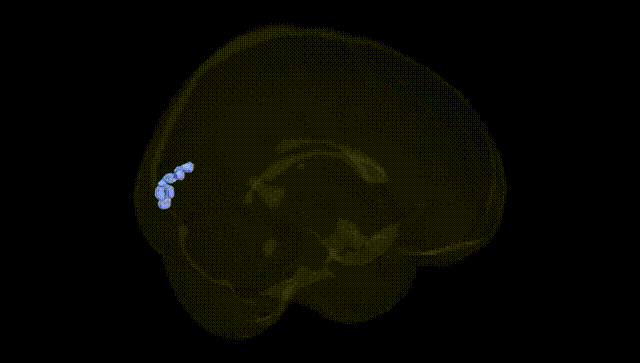Full Brain Black