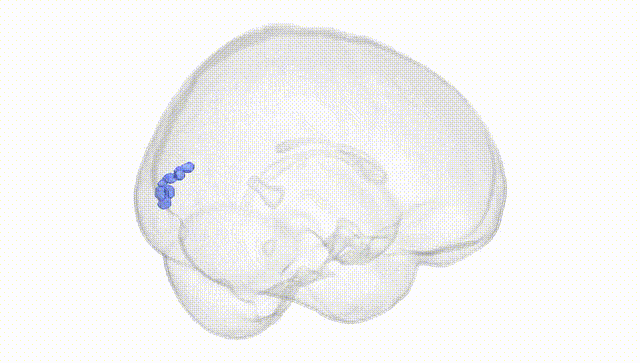 Full Brain White