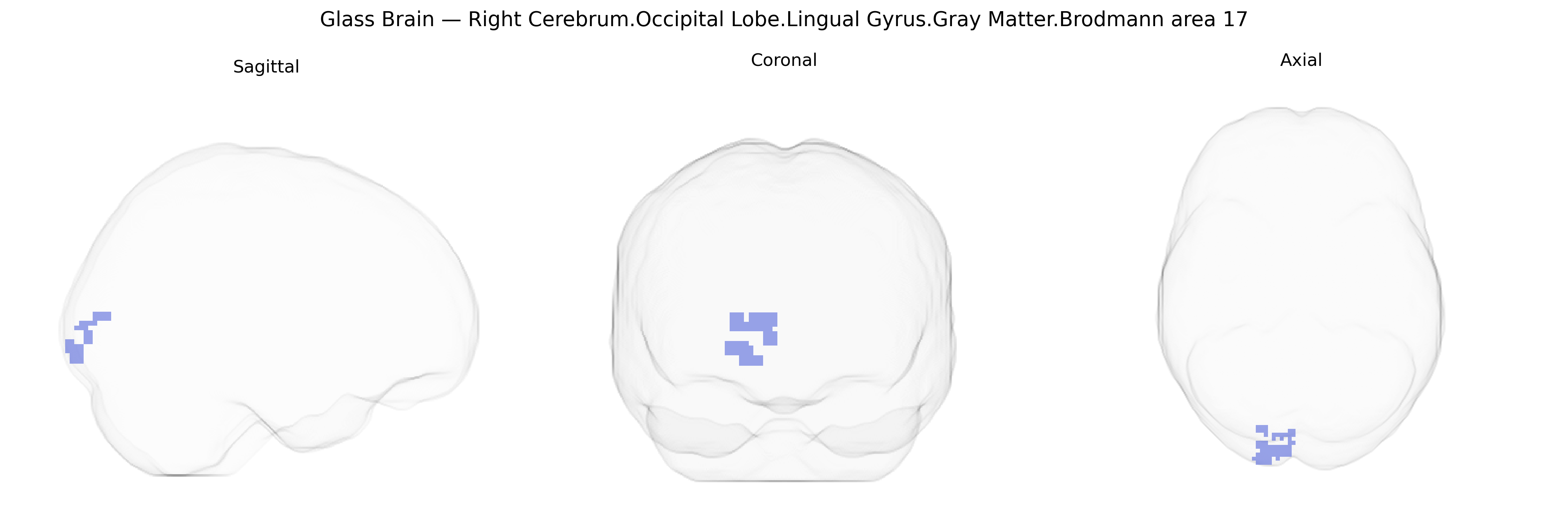 Triplanar Ghost Brain