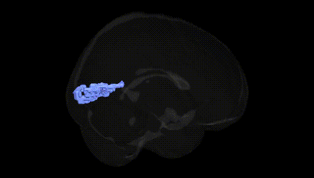 Full Brain Black
