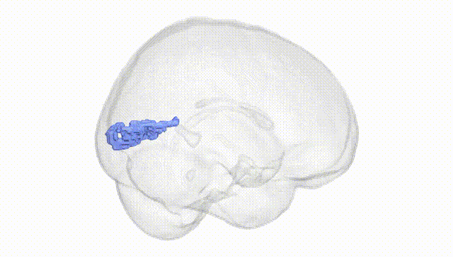 Full Brain White