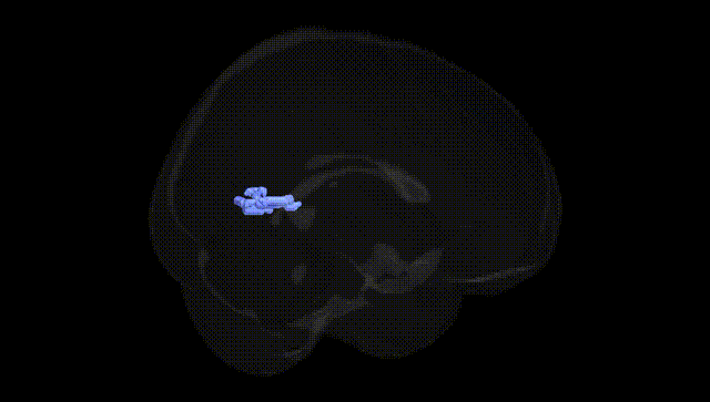 Full Brain Black
