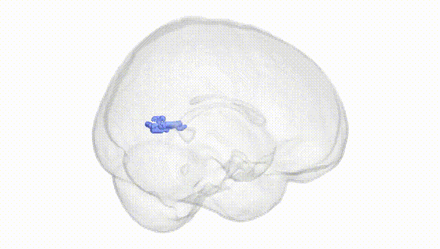 Full Brain White