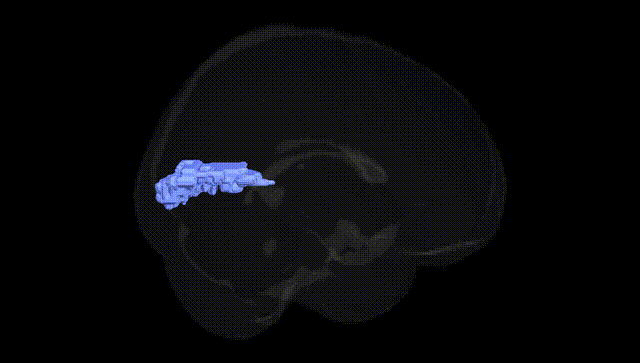 Full Brain Black