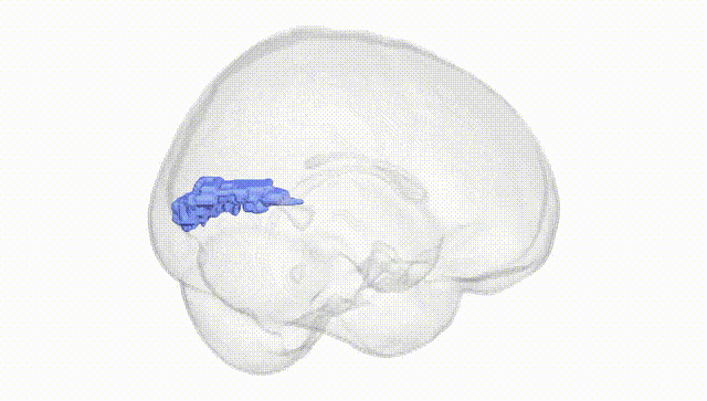 Full Brain White