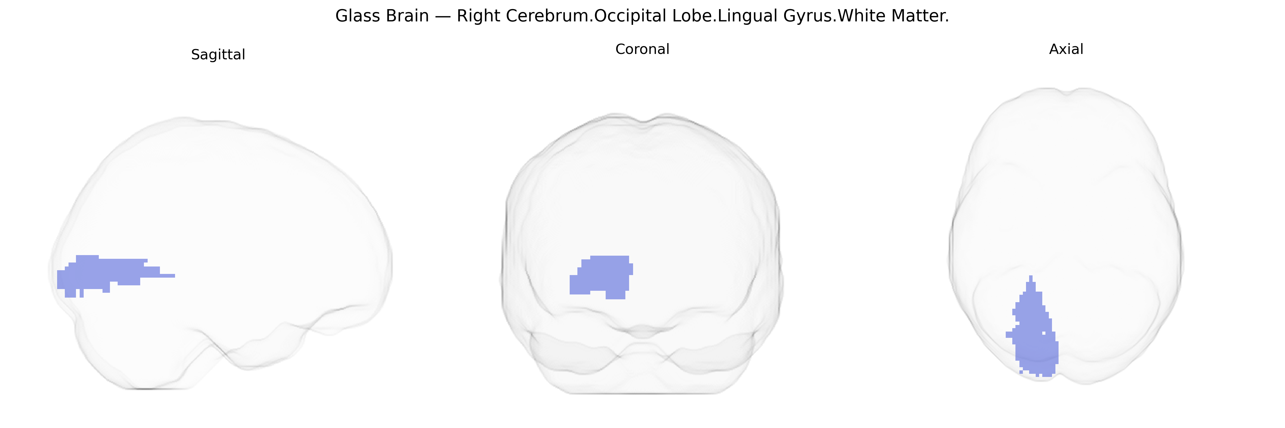 Triplanar Ghost Brain