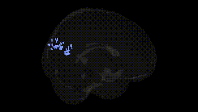 Full Brain Black