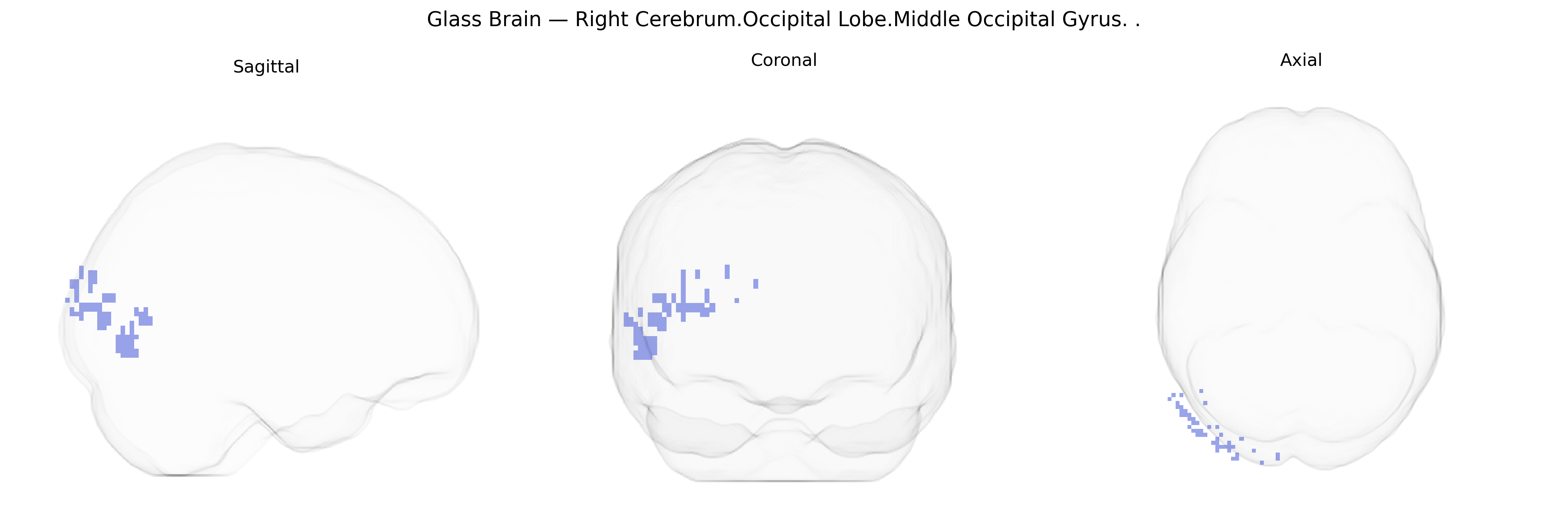 Triplanar Ghost Brain