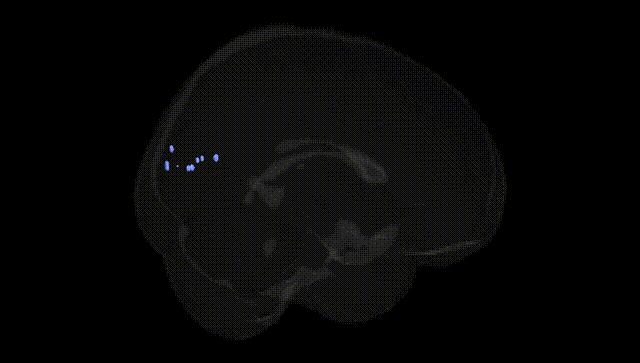 Full Brain Black