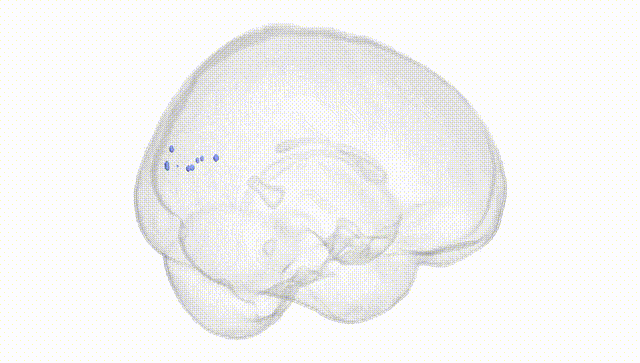 Full Brain White