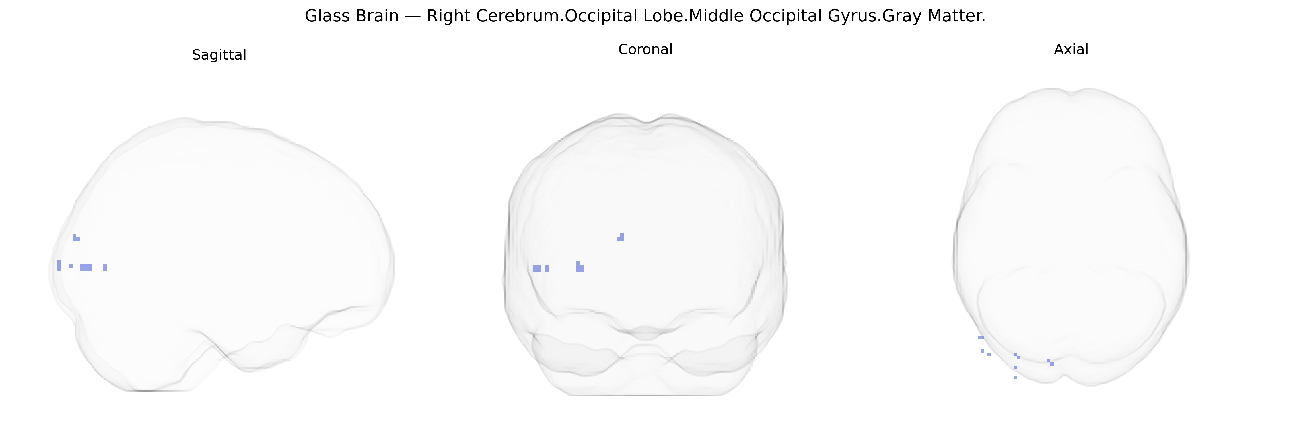 Triplanar Ghost Brain