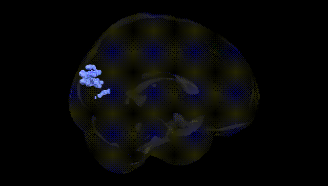 Full Brain Black