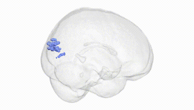 Full Brain White