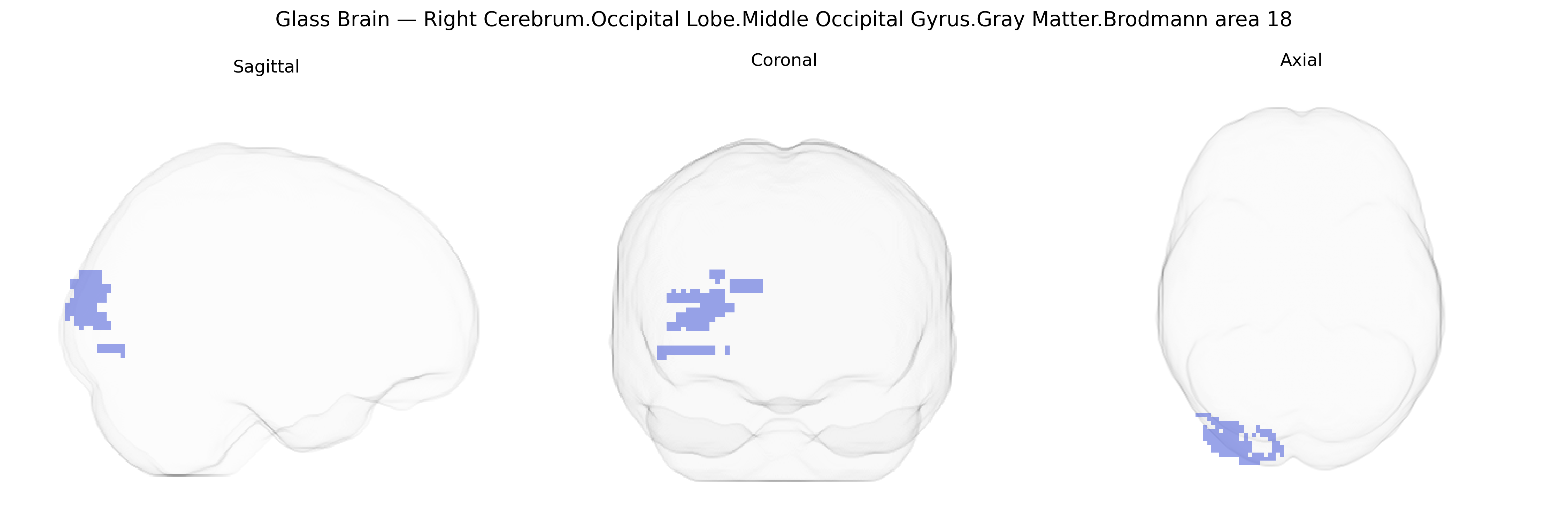 Triplanar Ghost Brain