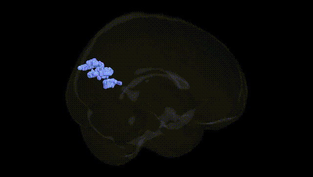 Full Brain Black