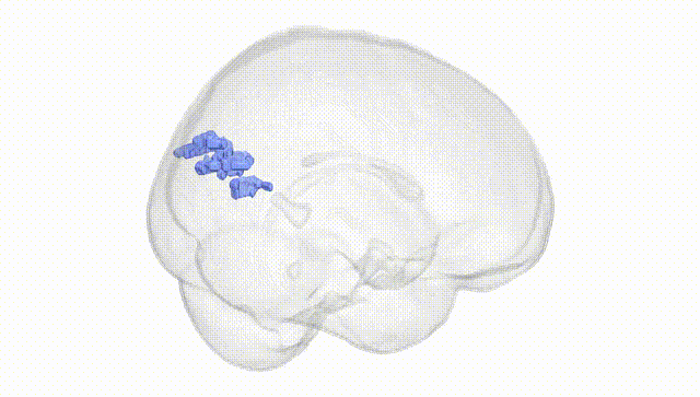 Full Brain White