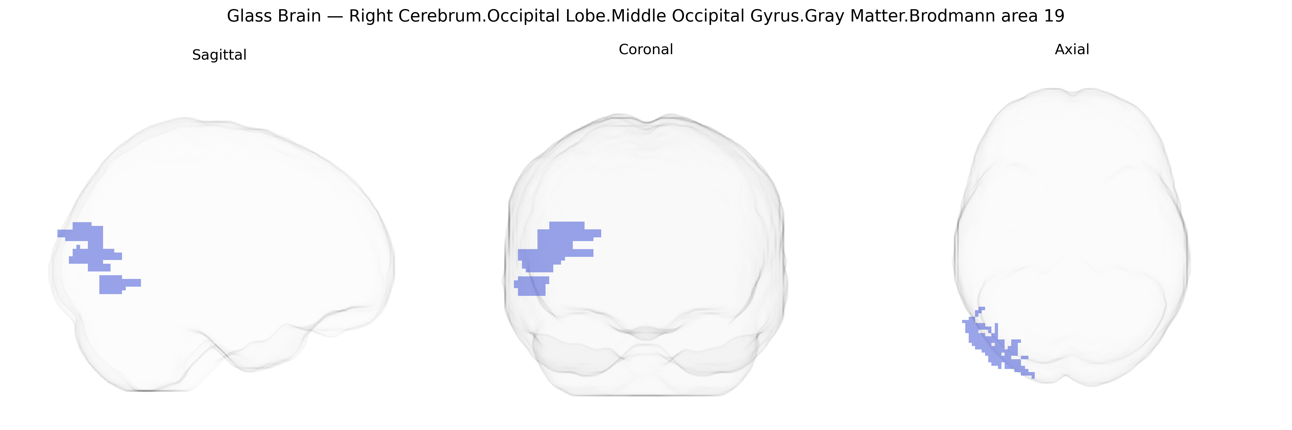Triplanar Ghost Brain