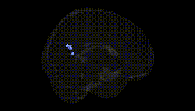 Full Brain Black