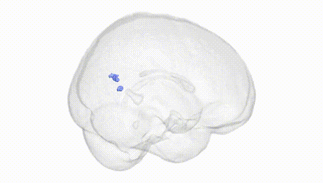 Full Brain White