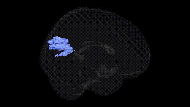 Full Brain Black