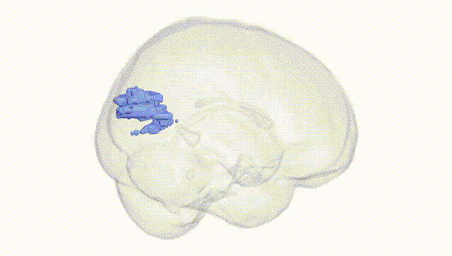 Full Brain White