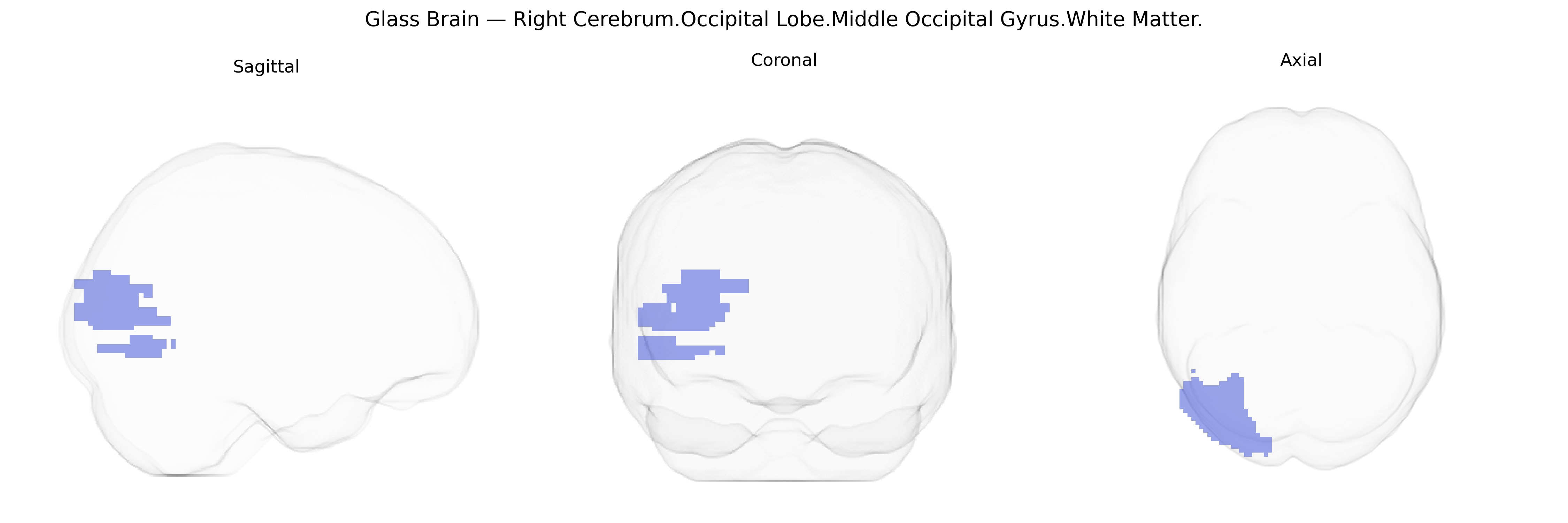 Triplanar Ghost Brain