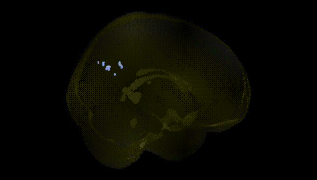 Full Brain Black