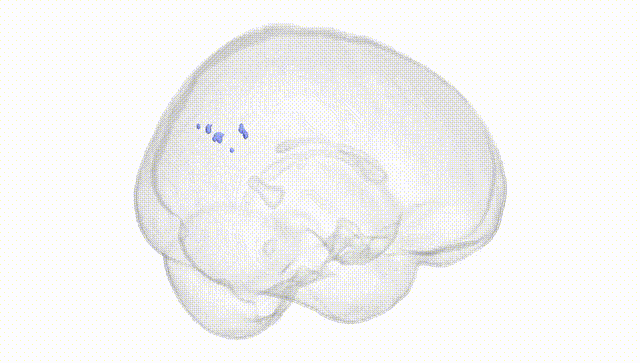 Full Brain White