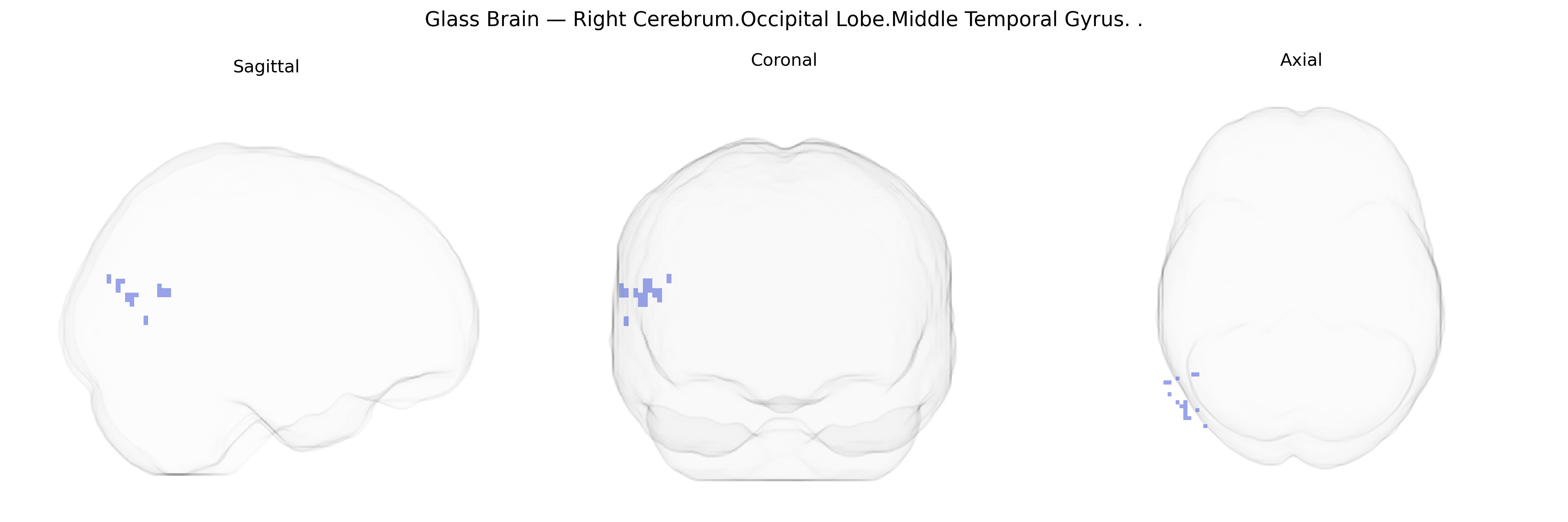 Triplanar Ghost Brain
