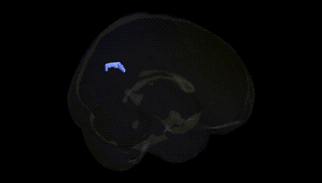 Full Brain Black