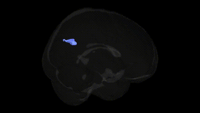 Full Brain Black