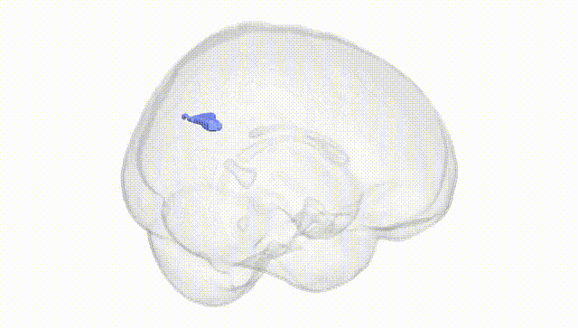 Full Brain White