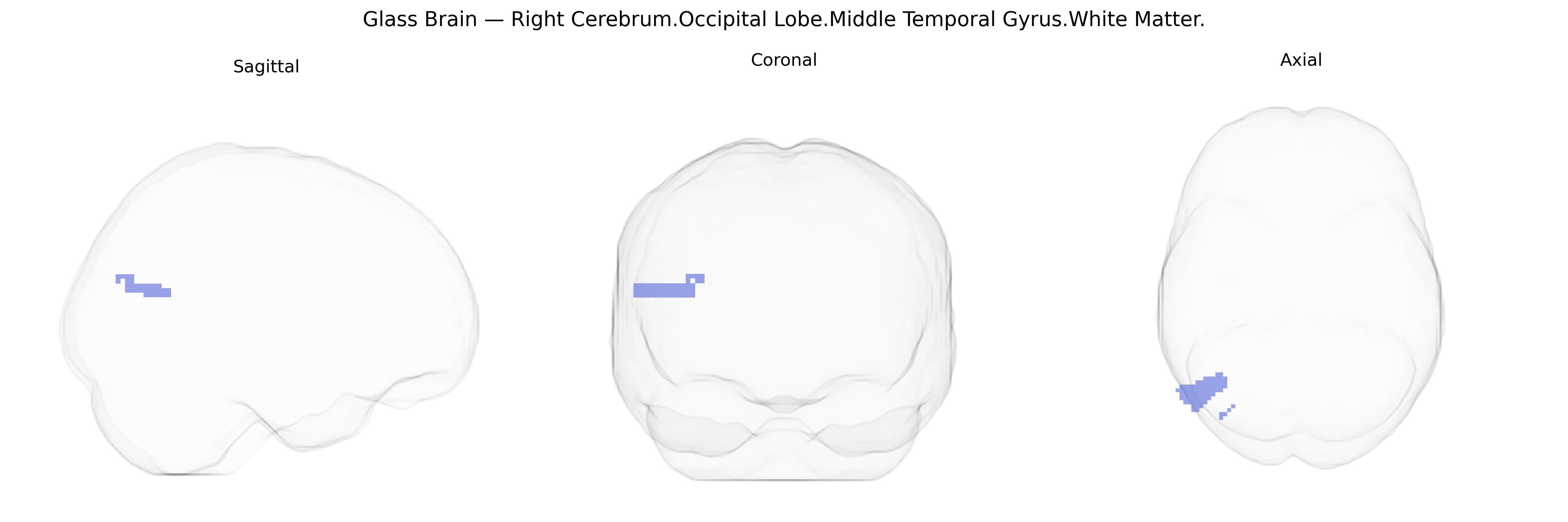 Triplanar Ghost Brain